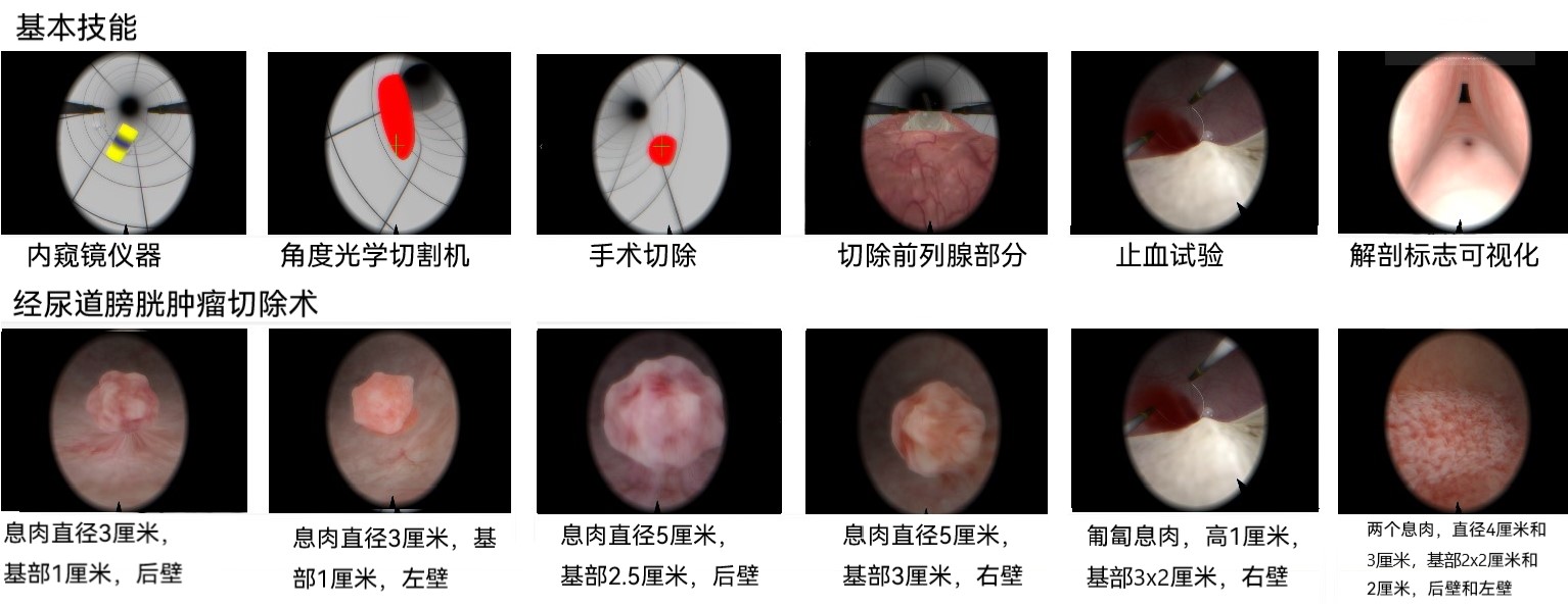 泌尿外科